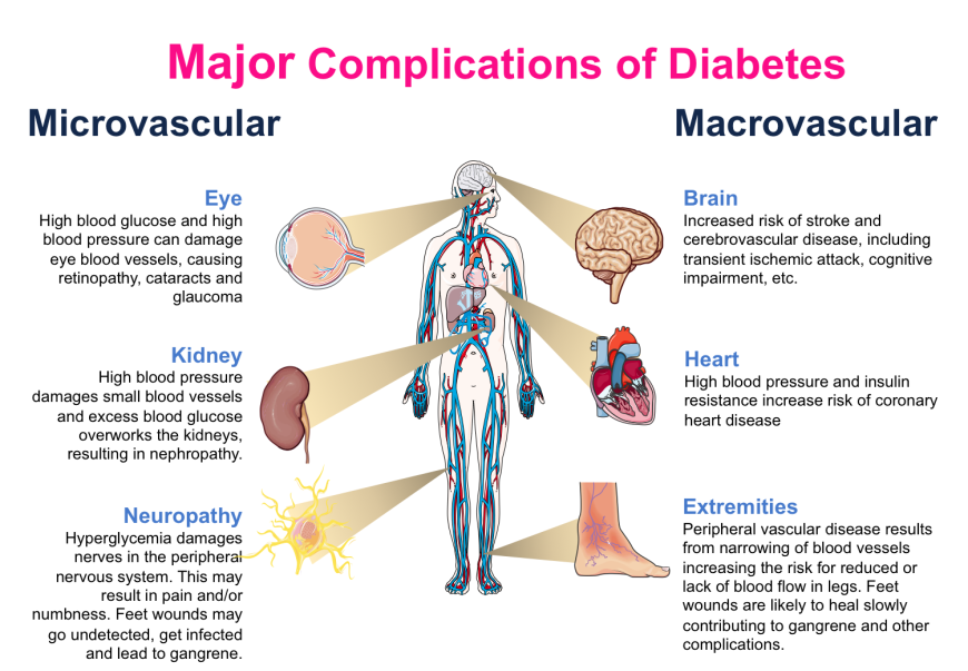 Figure 1. Major microvascular and macrovascular complications associated with diabetes mellitus. Parts of the image were adapted from Servier Medical Art.