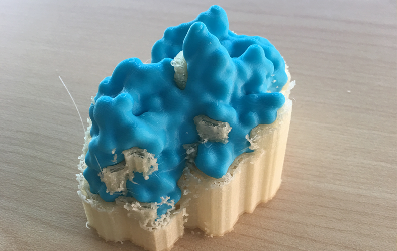 3D printed model of serum albumin with support system